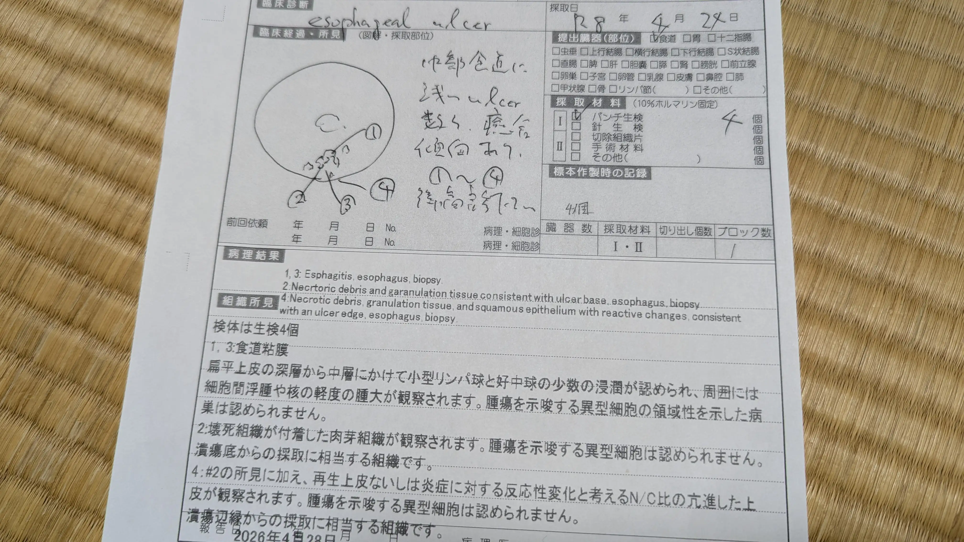 病理検査結果