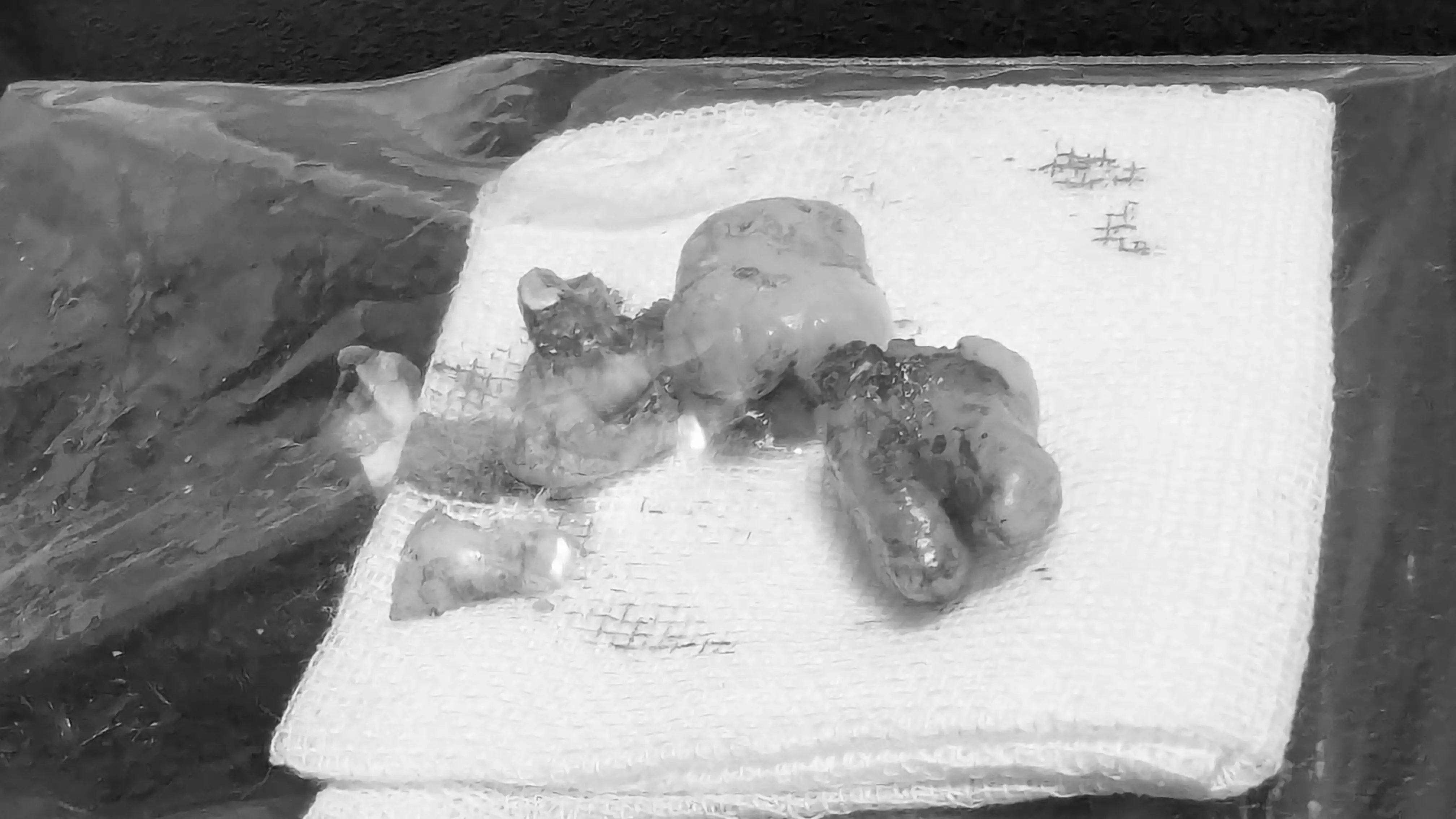 抜歯した親知らずの写真