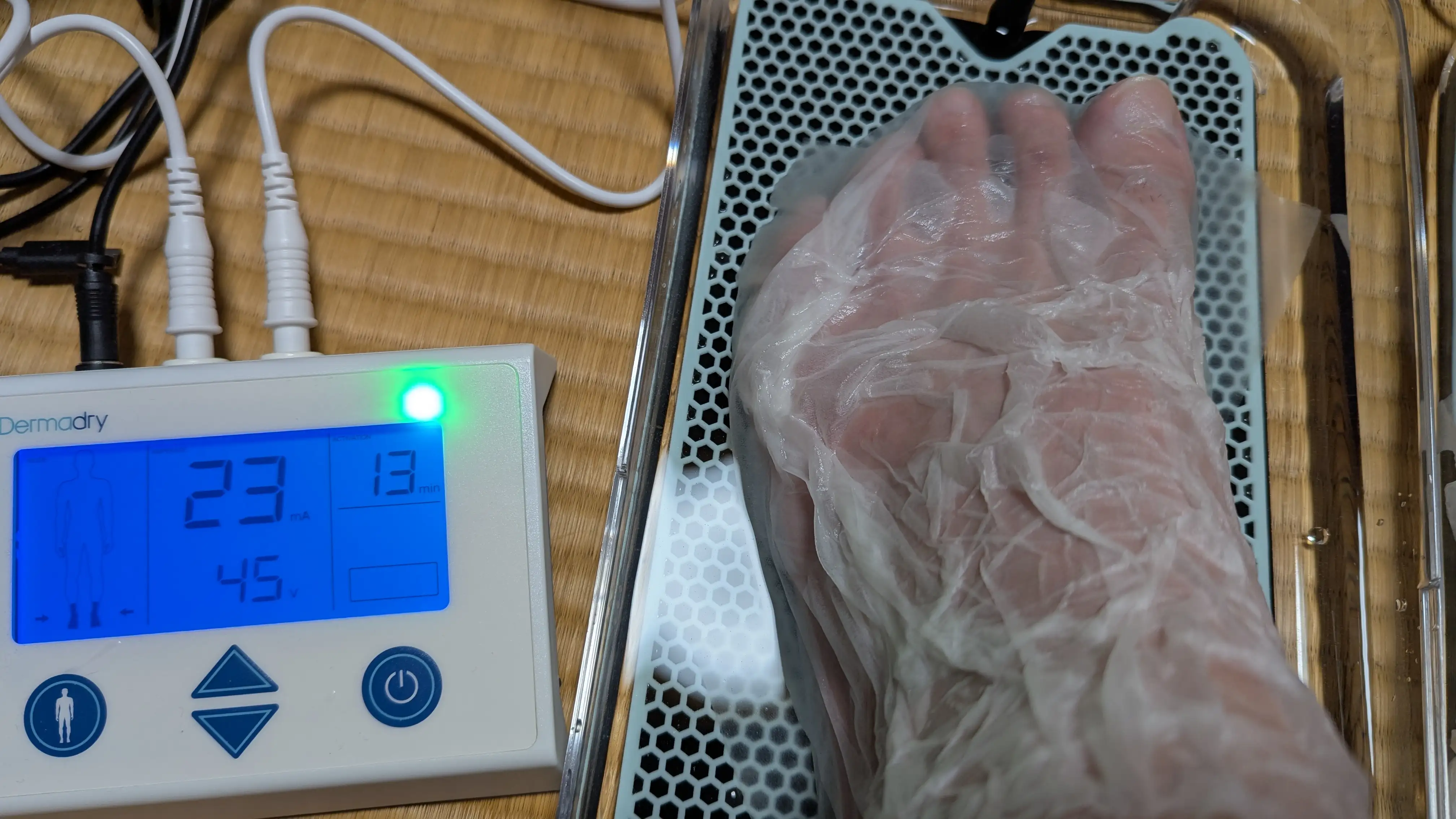 ダーマドライでティッシュをまとわせて使用している画像